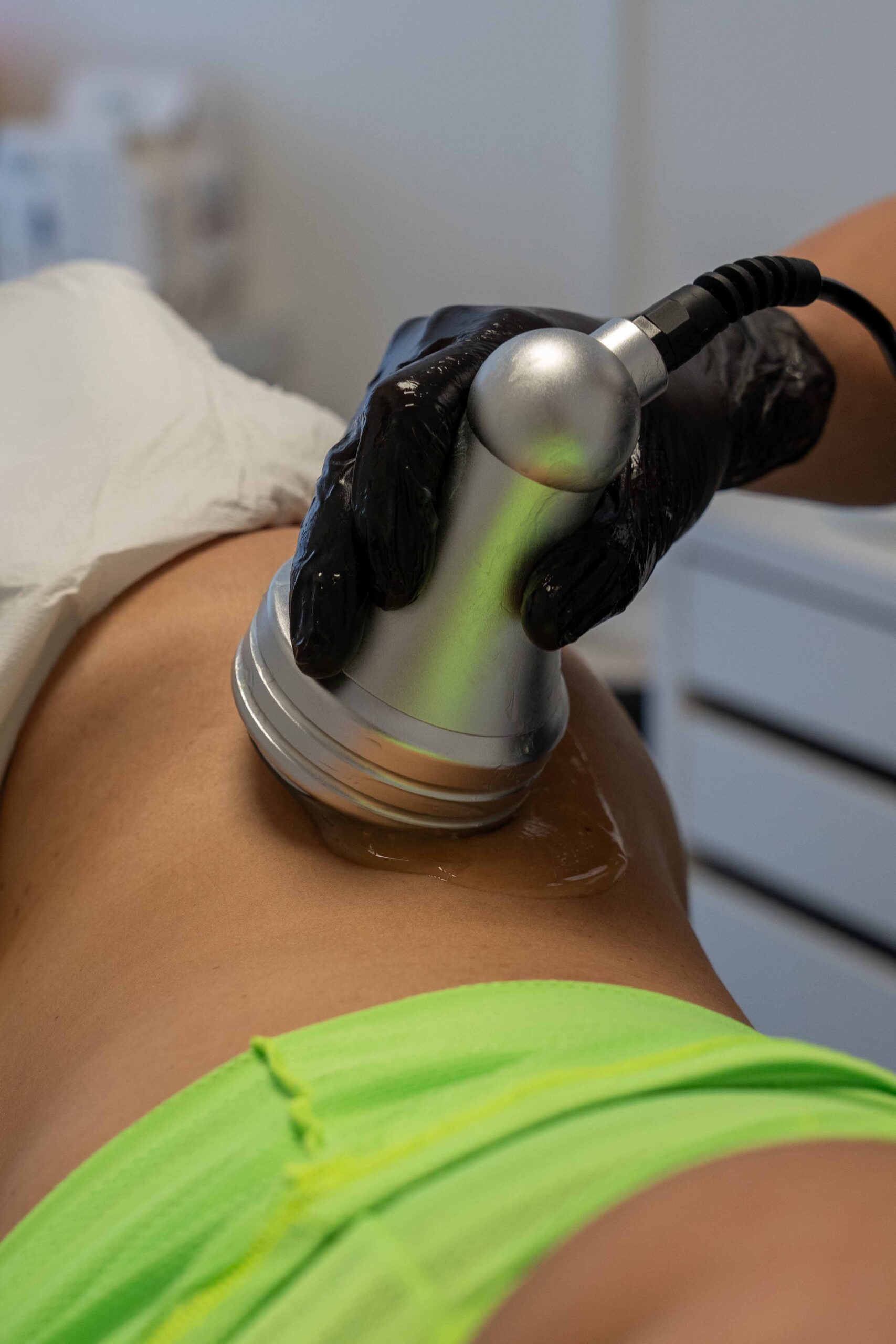 Cavitation